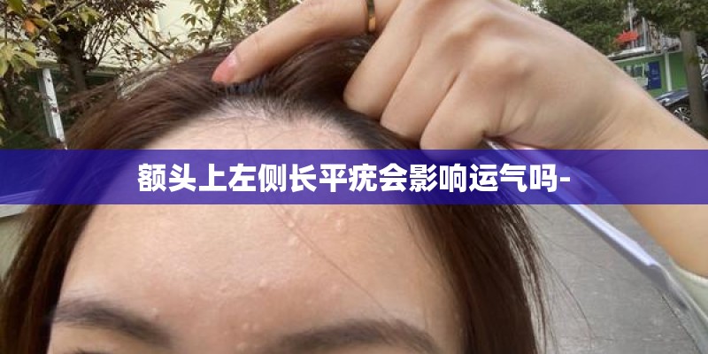 额头上左侧长平疣会影响运气吗-